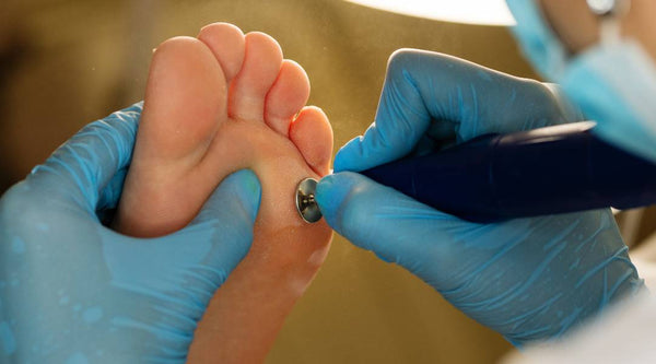 Say Goodbye to Stubborn Foot Calluses with These Tips!